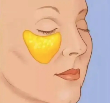 王春虎蘋果肌復(fù)位行嗎？