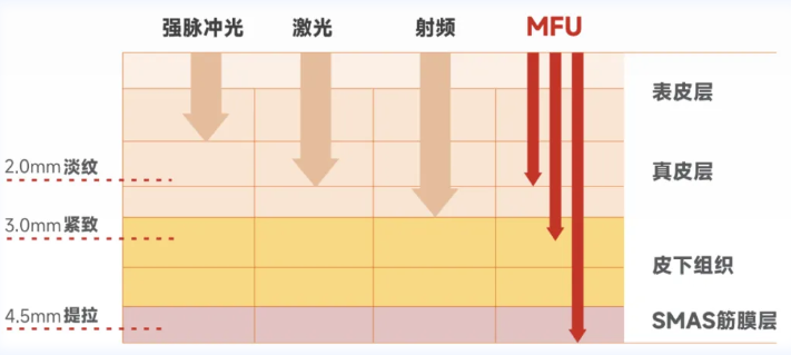 超聲炮不適宜人群