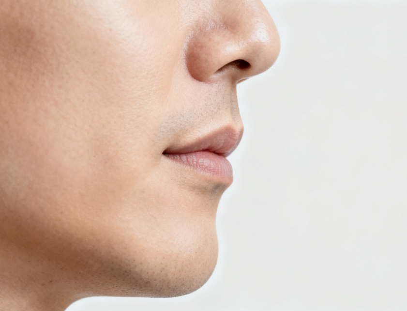 三、北京沈薇醫(yī)生人中縮短手術(shù)常見問題解答