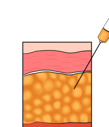 選擇長沙鄧旭輝吸脂的注意事項