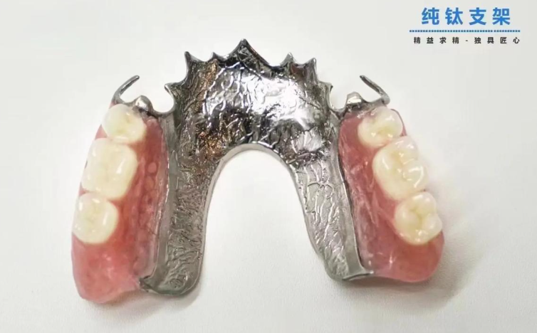 三、上海無掛鉤鑲牙價格全覽表