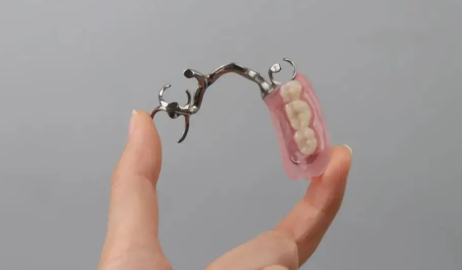 二、上海9家高性價比德國無掛鉤鑲牙牙科推薦