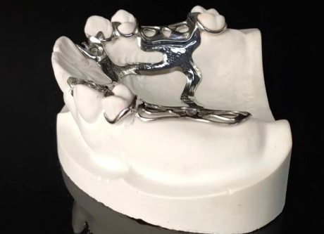 一、上海德國無掛鉤鑲牙技術(shù)解析