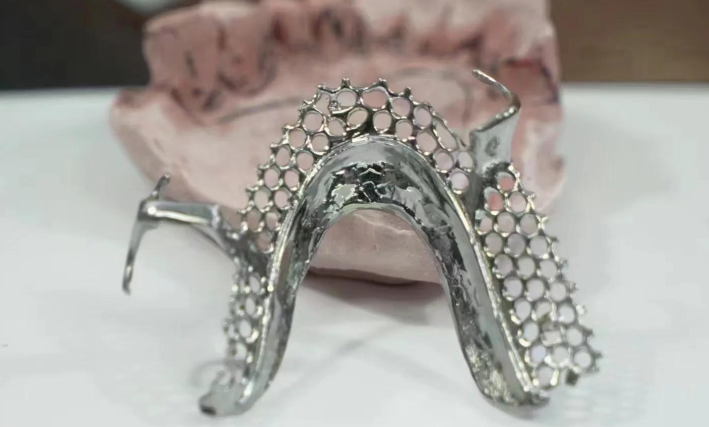 五、鑲牙后護理注意事項www.sorencai.cn