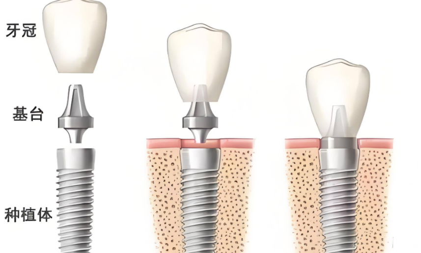 二、關于北京私立口腔醫(yī)院的收費情況
