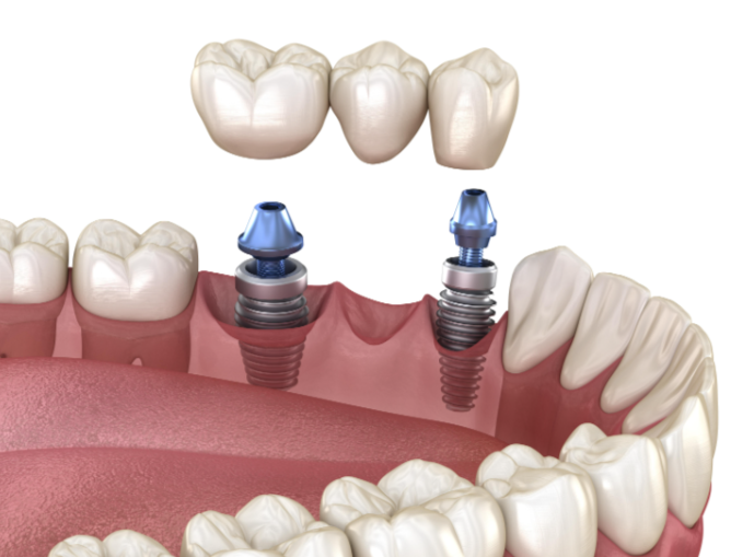 四、北京私立口腔醫(yī)院特色項目與醫(yī)生團隊