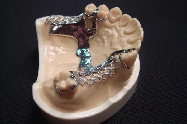 六、特別提醒：避免鑲牙陷阱