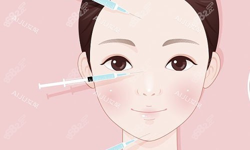 注射美容的部位示意圖