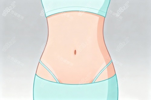 腰腹部做吸脂塑形卡通圖