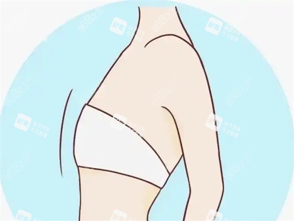 胸部縮小術(shù)