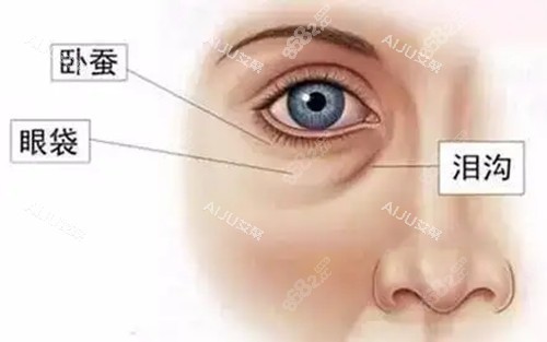 美萊整形醫(yī)院眼周項(xiàng)目做的怎么樣？ 2026祛眼袋/雙眼皮修復(fù)真實(shí)術(shù)例