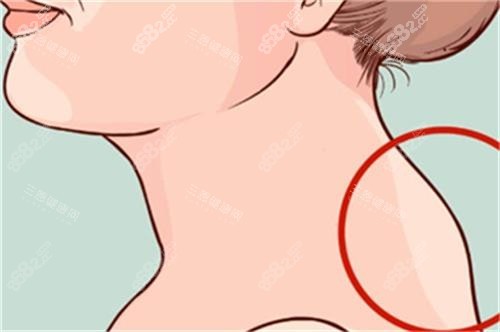 從側(cè)面看富貴包的位置