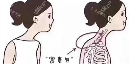 脖子富貴包卡通圖展示照片