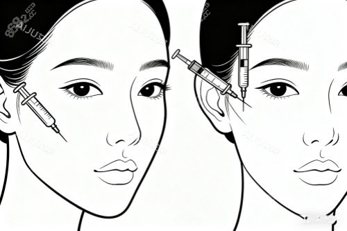 面部注射圖片一覽