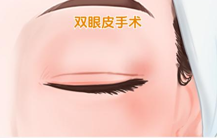 長沙彭遠清雙眼皮修復成效咋樣？
