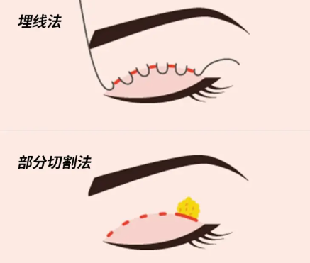 患者反饋與實例分析