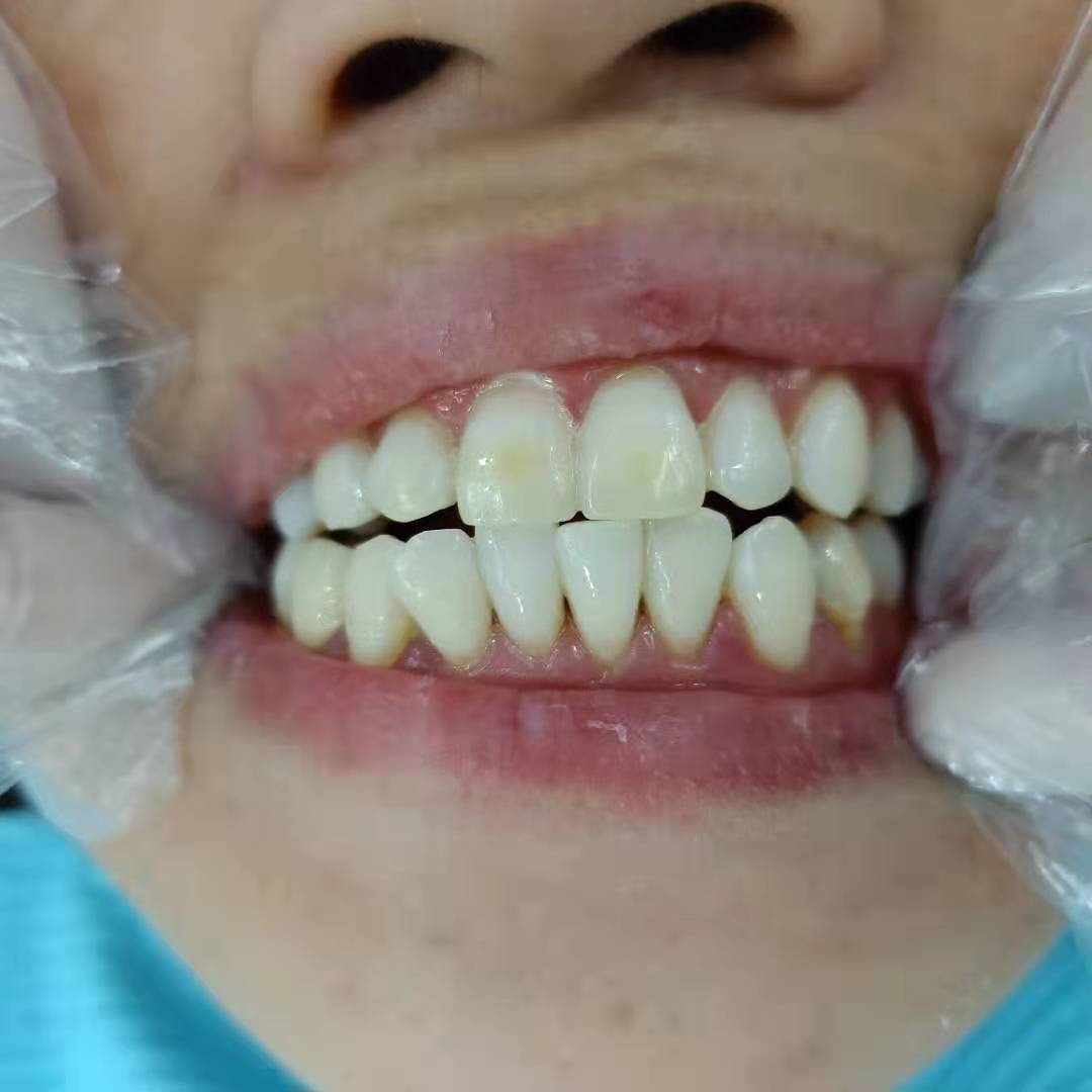 四、滎陽兆合口腔正畸與種植項(xiàng)目價(jià)格