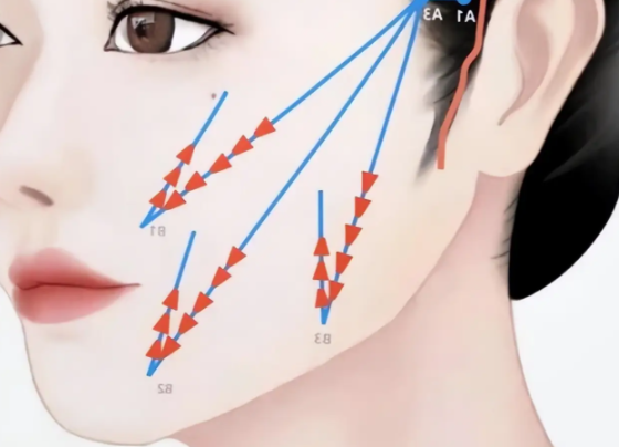 筋膜提升項目的原理與優(yōu)勢