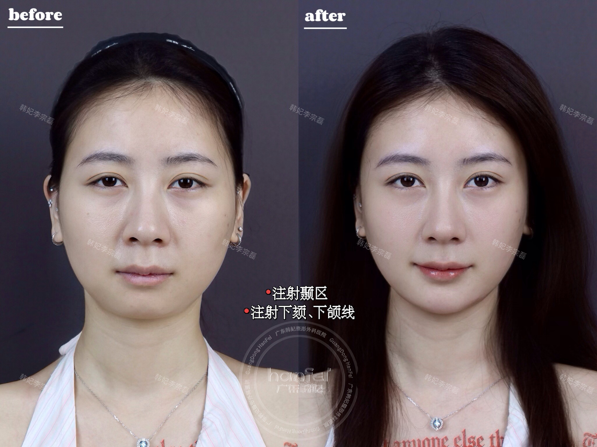 醫(yī)院的個(gè)性化服務(wù)