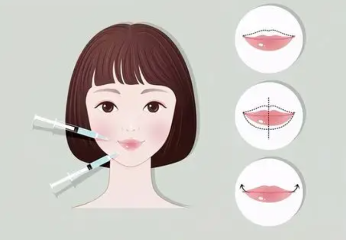 上海麗質(zhì)盧九寧整形靠譜嗎之真實(shí)實(shí)例