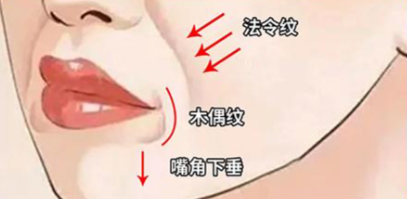 提升（輪廓固定）