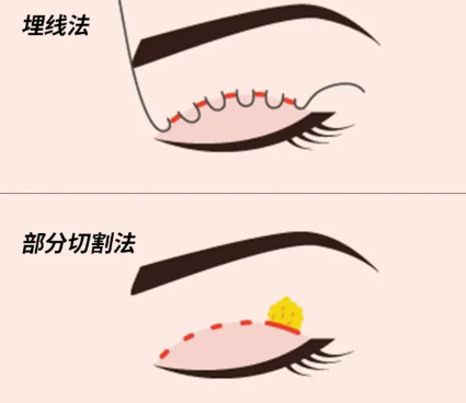 李石峰醫(yī)生的專門背景與經(jīng)驗