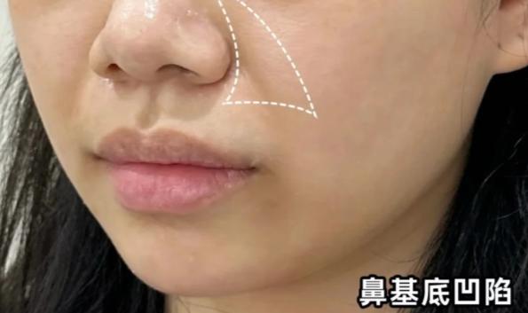 三、總結(jié)