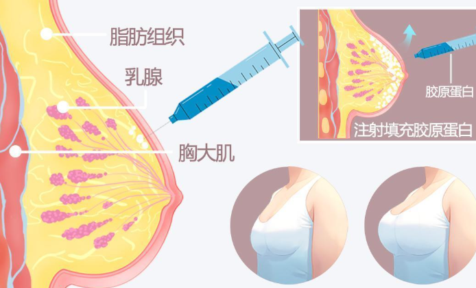 二、同一品牌不同分子結(jié)構(gòu)的玻尿酸價(jià)格差異原因www.sorencai.cn