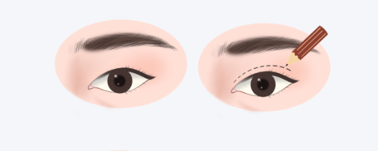 與其他醫(yī)生對(duì)比優(yōu)勢(shì)