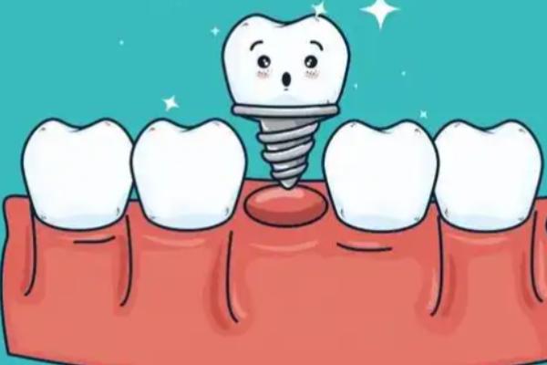 海涛口腔兰州有几家店？9家门店地址及乘车路线曝光，附种植牙、矫正价格表 