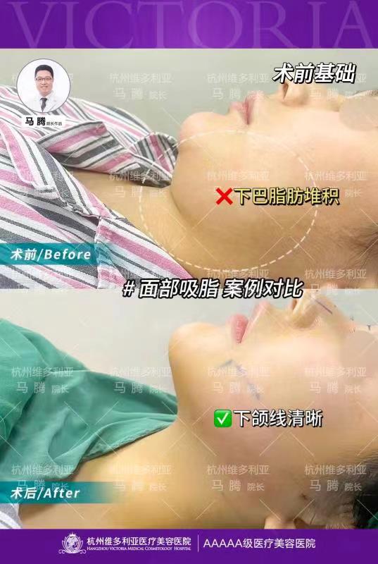 五、激光脫毛等皮膚項目價格www.sorencai.cn