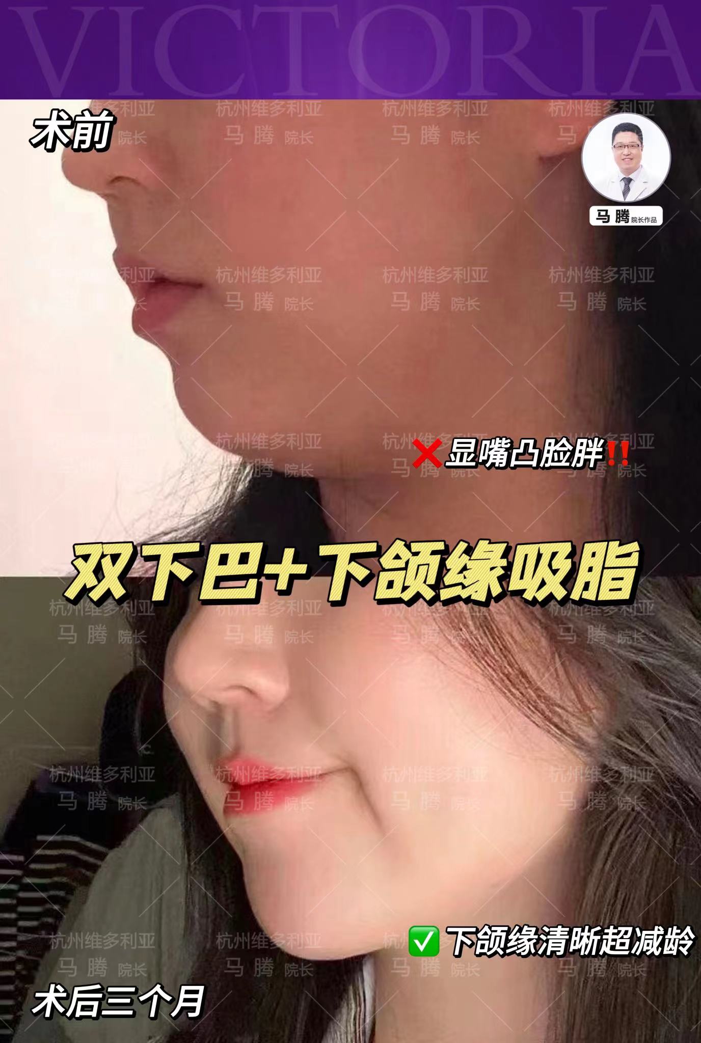 六、2026年人氣醫(yī)生名單推薦