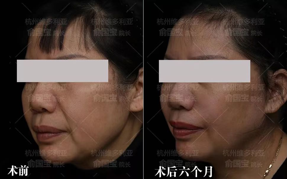 四、2026年注射美容項目價格表