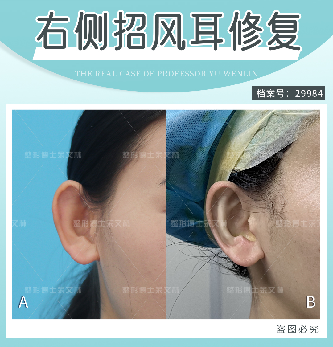 患者真實(shí)反饋：術(shù)后效果滿意，服務(wù)貼心