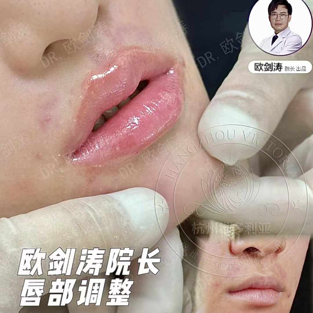 八、2026年變得更美，就選杭州維多利亞整形