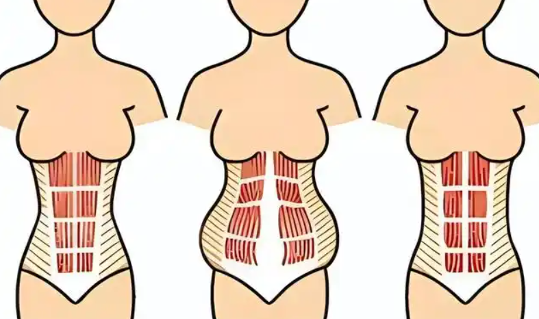 五、南京地區(qū)腹壁整形機(jī)構(gòu)對比