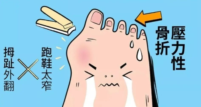 3. 手術(shù)費(fèi)用參考：透明無隱形消費(fèi)，心里有底