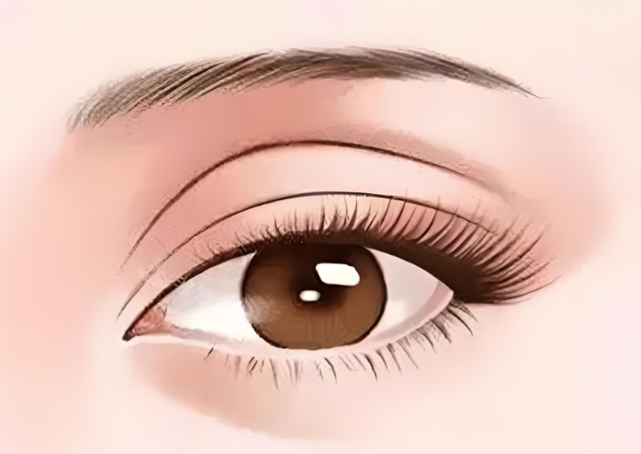 上海韓立志修復(fù)雙眼皮真實價格省錢攻略