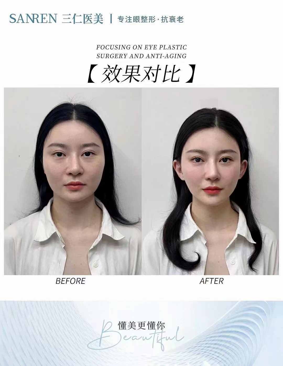 廣州正規(guī)三等甲美容醫(yī)院部位適配，價(jià)格怎么算