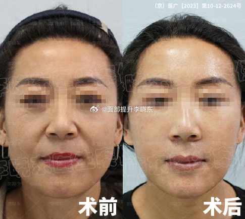 七、真實(shí)用戶評價(jià)反饋