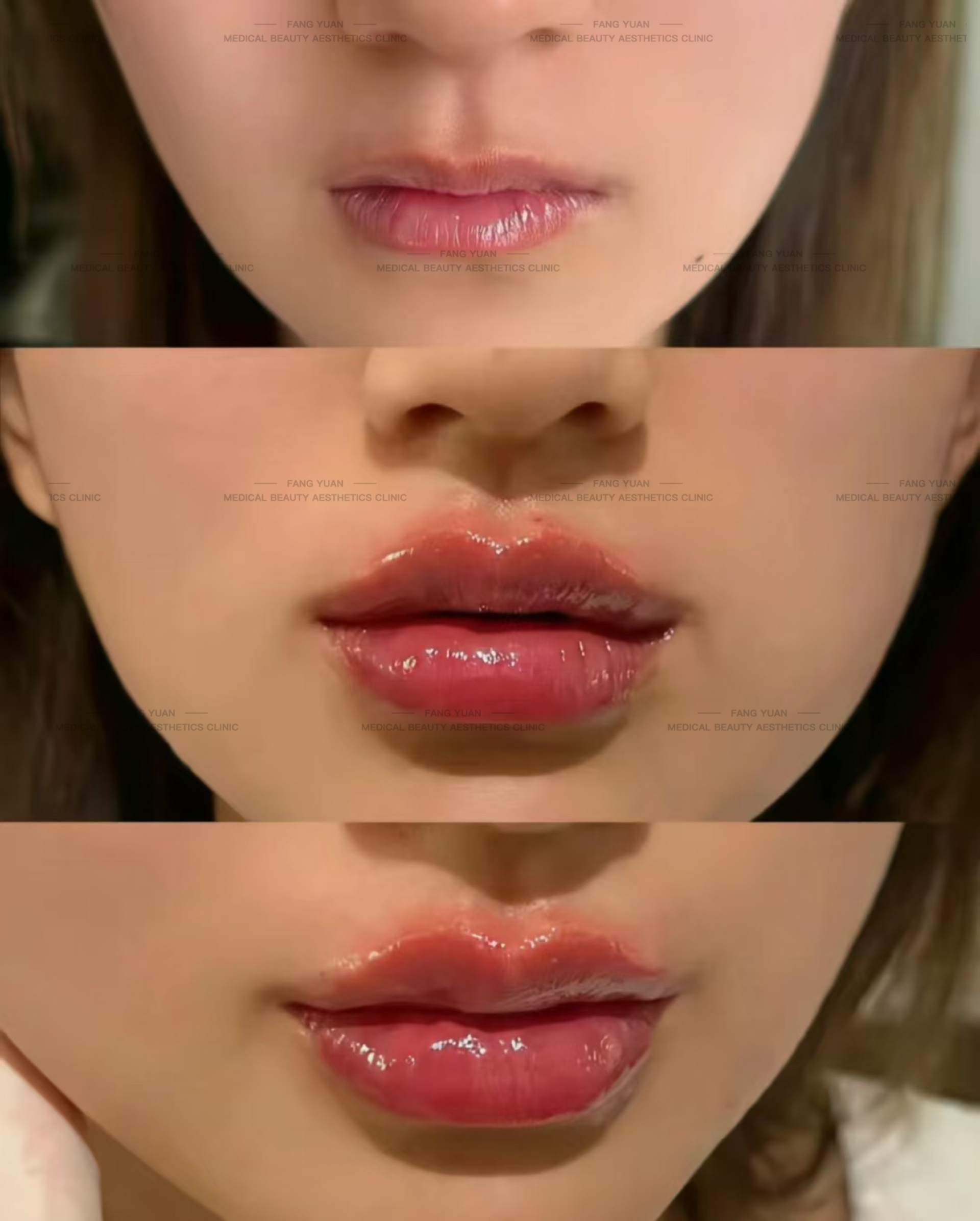 合肥周瑜修復(fù)降?。横t(yī)生實(shí)力大揭秘