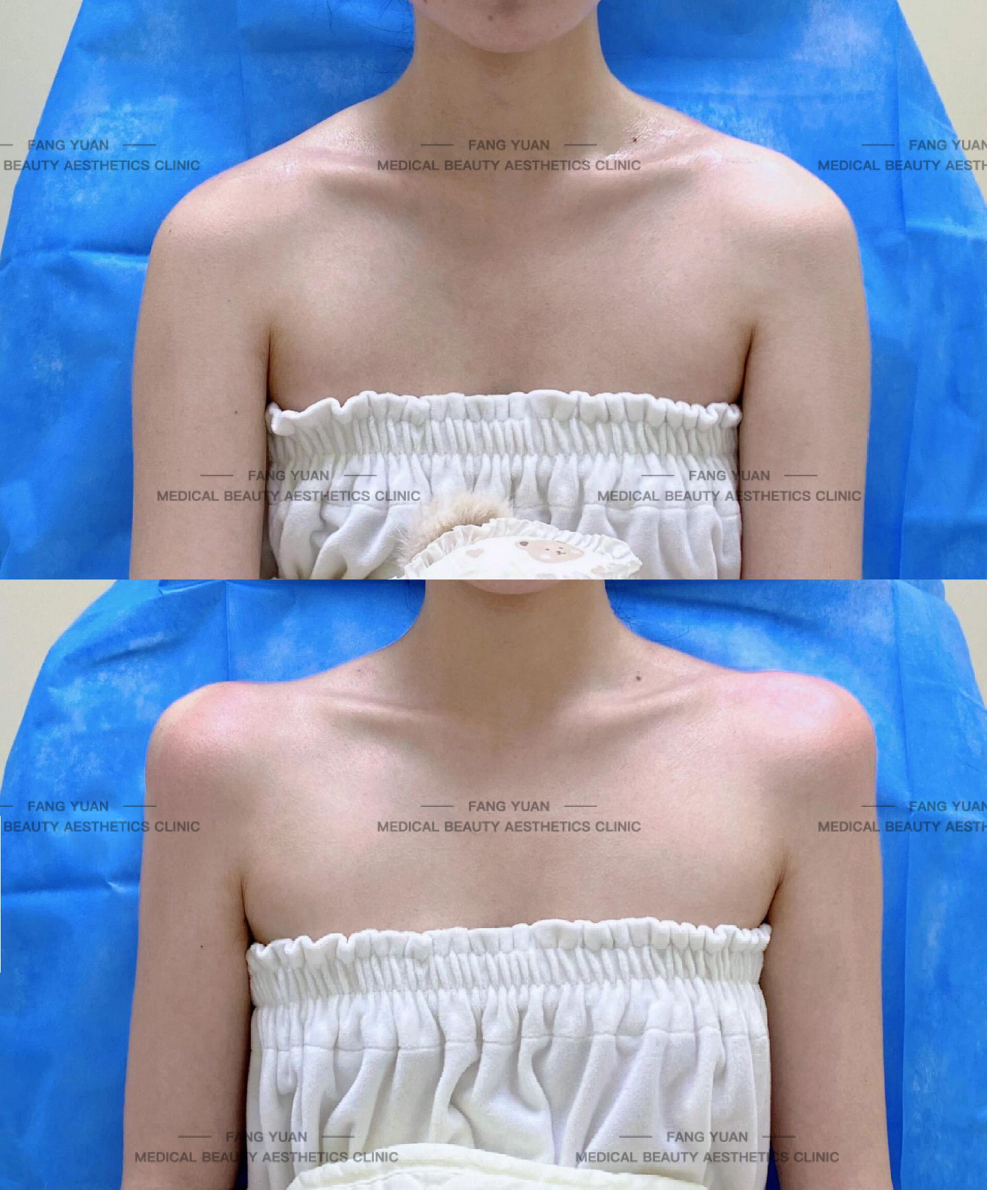 合肥周瑜修復(fù)降?。杭夹g(shù)優(yōu)勢全知道