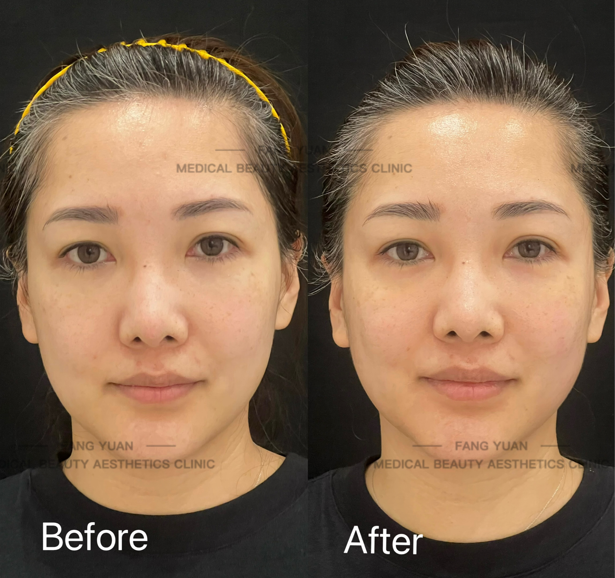 合肥周瑜修復(fù)降?。簝r格與服務(wù)有亮點(diǎn)www.sorencai.cn