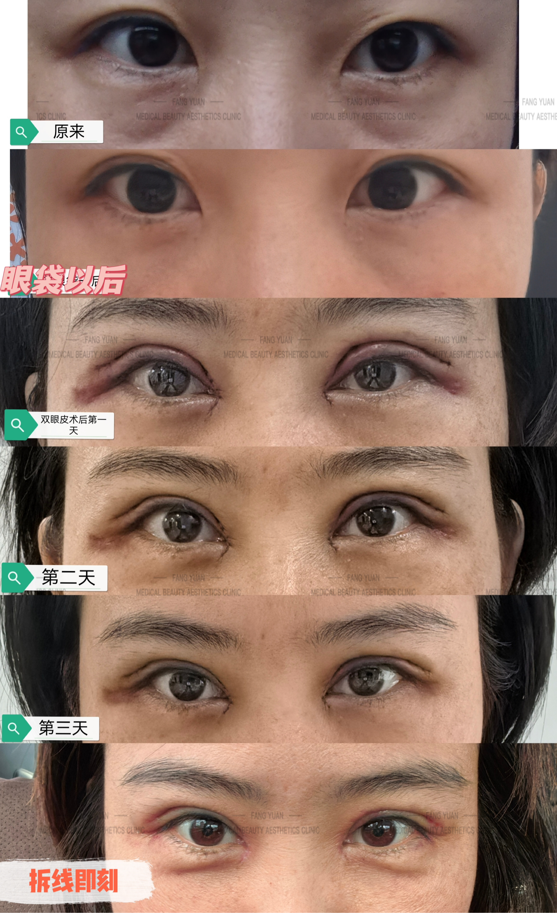 合肥周瑜修復(fù)降肌：預(yù)約方式要記牢