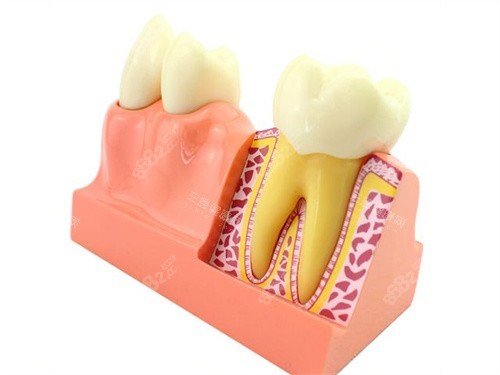 牙齒解剖模型 牙齒解剖模型