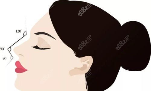 鼻整形示意圖 鼻整形示意圖