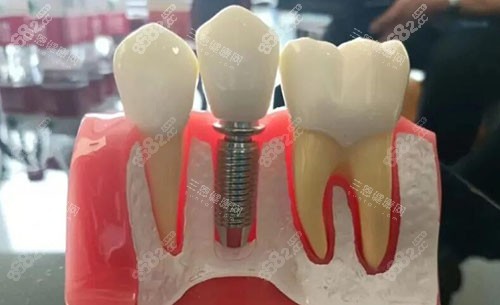 黃岡新起點(diǎn)口腔牙齒模型實(shí)拍圖 黃岡新起點(diǎn)口腔牙齒模型實(shí)拍圖