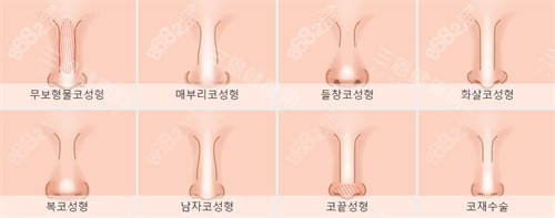 不同需要進行鼻整形的鼻子