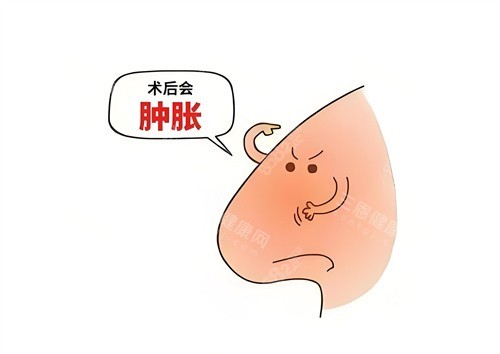 隆鼻術(shù)后腫脹動(dòng)畫圖