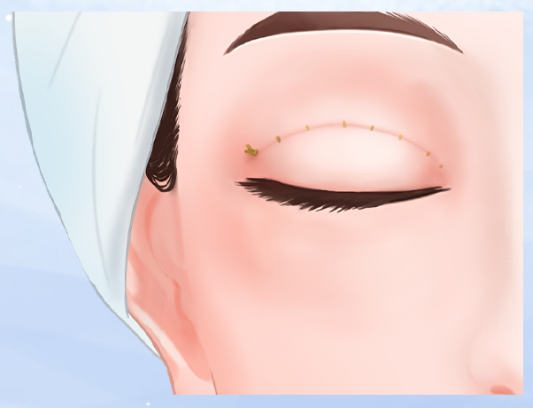 醫(yī)生技術(shù)風(fēng)格對(duì)比